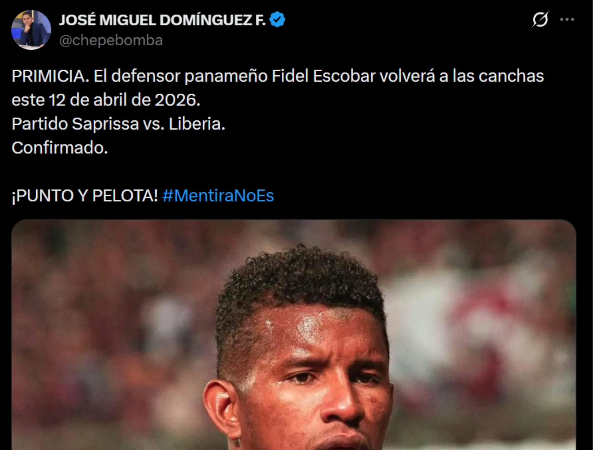 Fidel Escobar volvería contra Liberia.