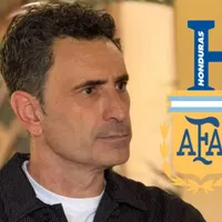 José Francisco Molina recibe certero golpe que sacude a la Selección de Honduras para enfrentar a Argentina