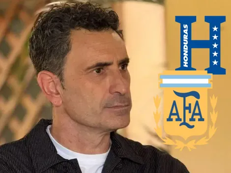 José Francisco Molina recibe certero golpe que sacude a la Selección de Honduras para enfrentar a Argentina