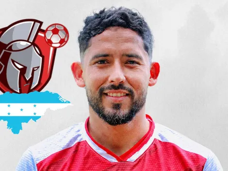 “No hay mucho que hacer”: Lesvin Medina rompe el silencio tras su brutal agresión y la noticia es devastadora sobre su ojo