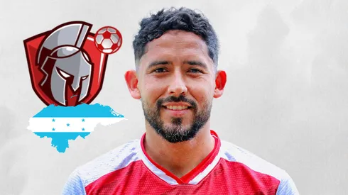 Lesvin Medina sufrió una brutal agresión en la Liga de Ascenso en Honduras. Foto: Arsenal SAO.