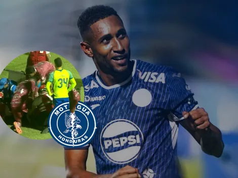 Todo Motagua consternado por la última noticia de la lesión de Romario Da Silva y el tiempo que estaría de baja