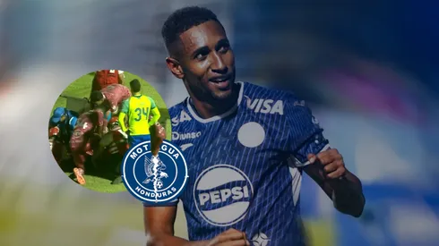 Romario Da Silva sufrió una terrible lesión en el juego ante el Olancho FC. Foto: X Motagua.