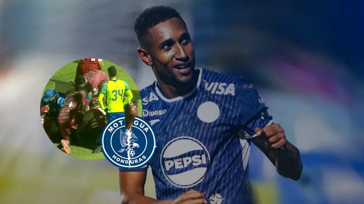 Romario Da Silva sufrió una terrible lesión en el juego ante el Olancho FC. Foto: X Motagua.