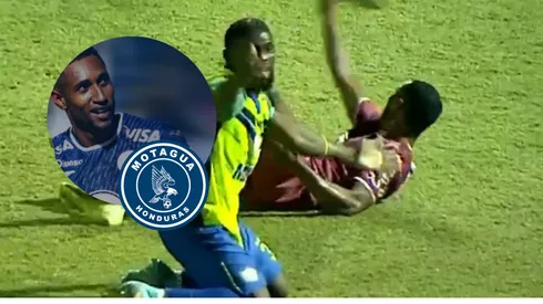 Romario Da Silva sufrió una luxofractura de peroné en el juego ante el Olancho FC. Foto: X Motagua.