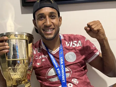 La decisión oficial de Motagua con Romario Da Silva tras su dura lesión